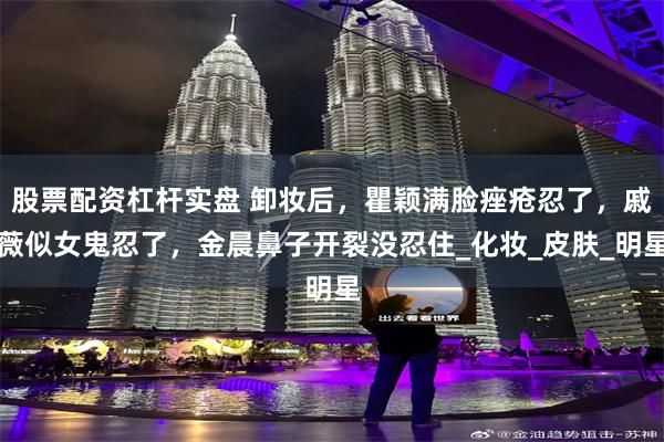 股票配资杠杆实盘 卸妆后,瞿颖满脸痤疮忍了,戚薇似女鬼忍了,金晨鼻子开裂没忍住_化妆_皮肤_明星